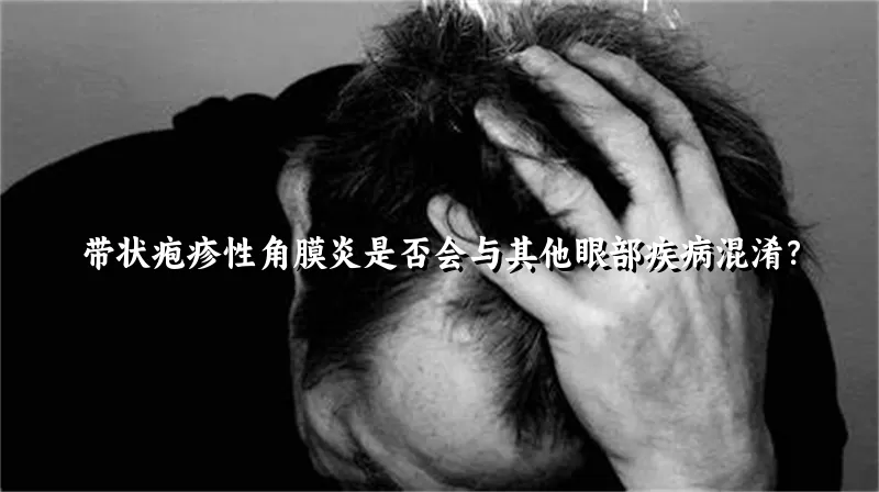带状疱疹性角膜炎是否会与其他眼部疾病混淆？