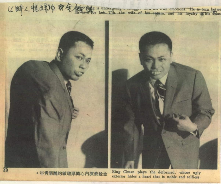 畸人艳妇-金铨饰演内心纯厚聪敏的丑陋青年 畸人艳妇-金铨饰演内心纯厚聪敏的丑陋青年