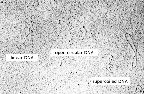 电子显微镜下的单链、环状、超螺旋DNA