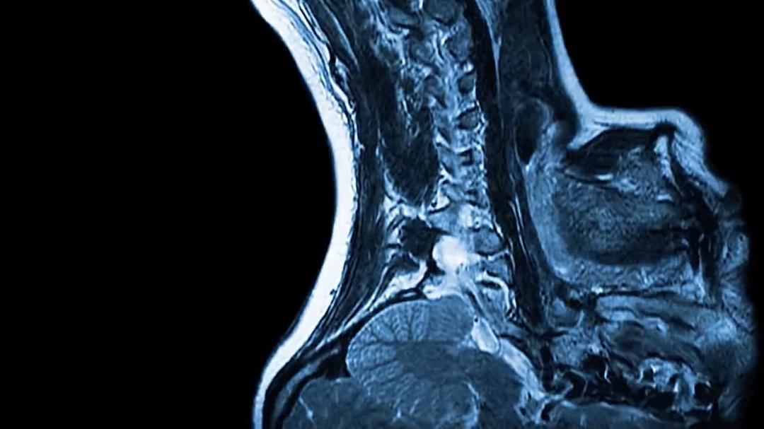 拉卡(2017)的剧照 拉卡(2017)的剧照